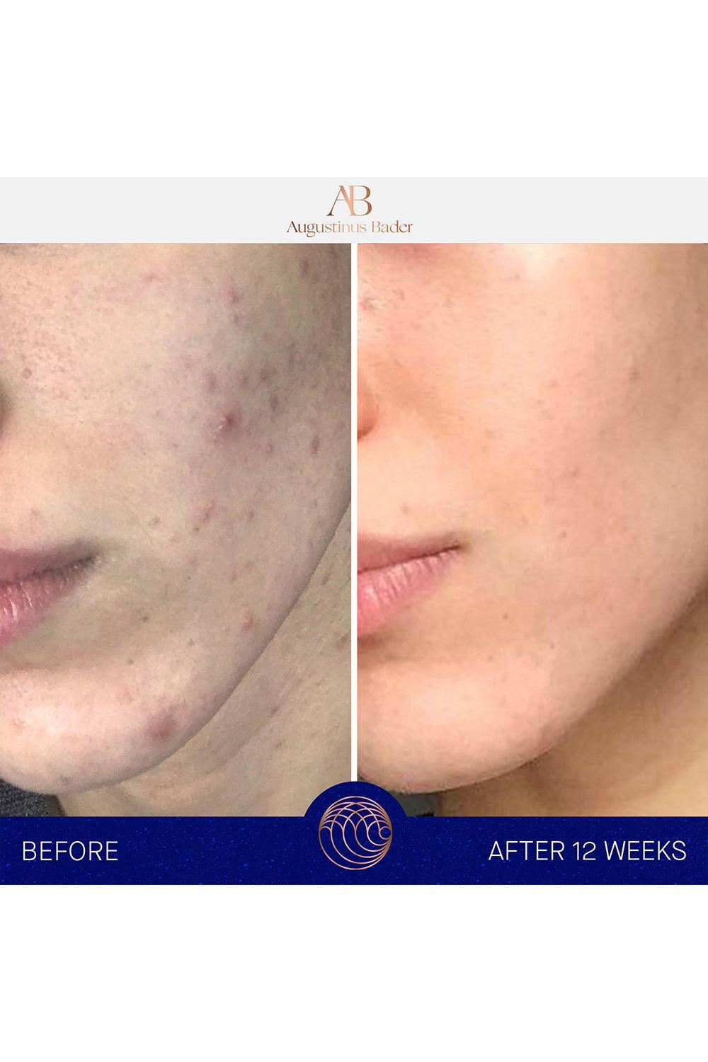 The Cream - 50ml-50ML-BEAUTYSKINCARE-AUGUSTINUS BADER