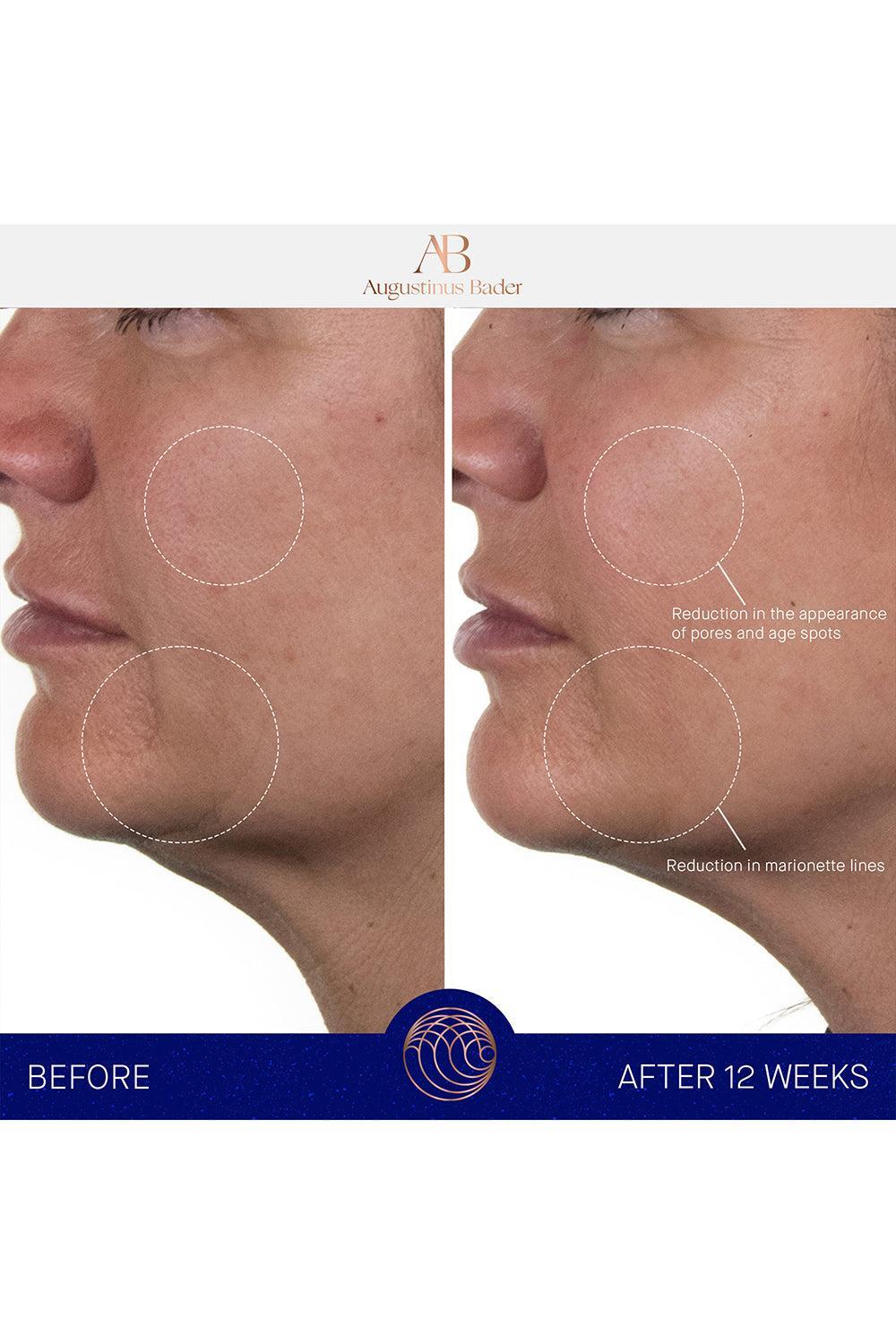 The Rich Cream-50ML-BEAUTYSKINCARE-AUGUSTINUS BADER