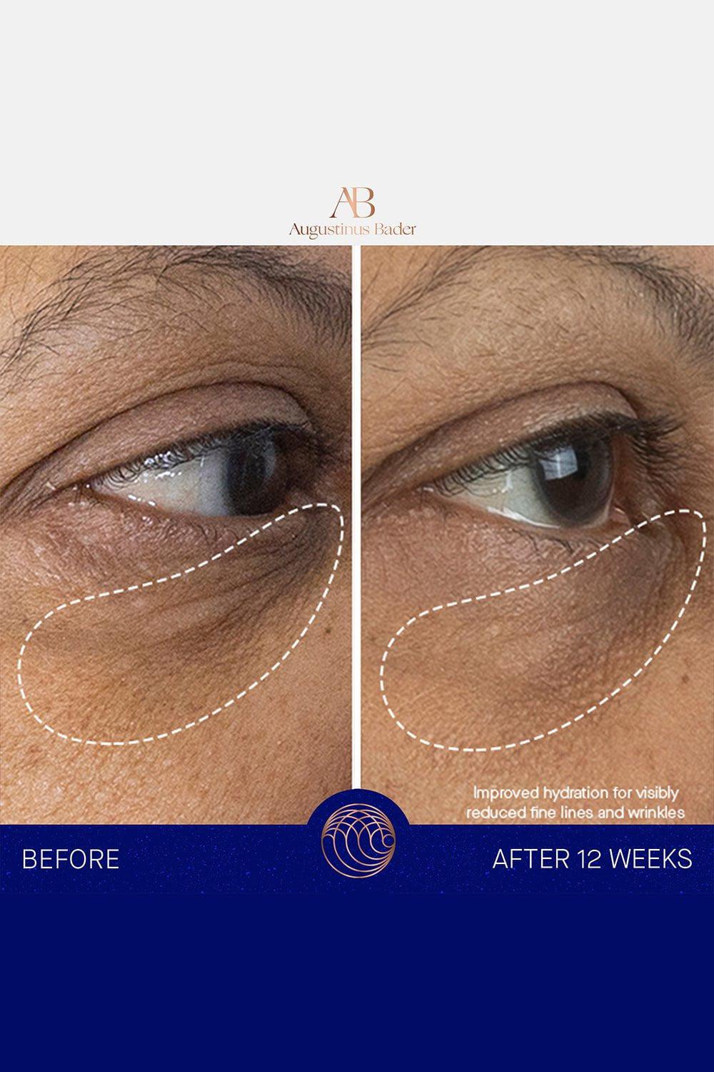 AUGUSTINUS BADER-The Eye Cream 15ML-15ML