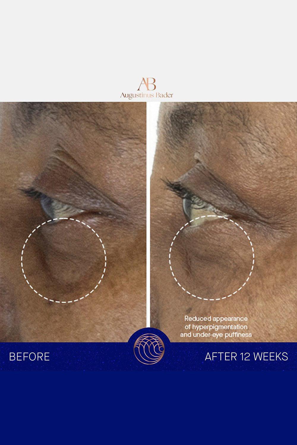 AUGUSTINUS BADER-The Eye Cream 15ML-15ML