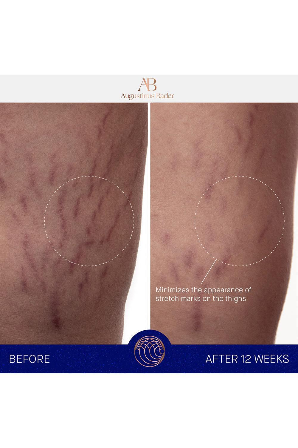 The Body Cream-200ML-BEAUTYSKINCARE-AUGUSTINUS BADER